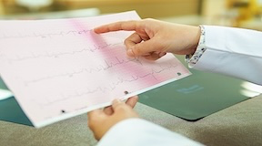 Médica apontando em  um eletrocardiograma