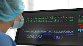 Enfermeira olhando o monitor de eletrocardiograma